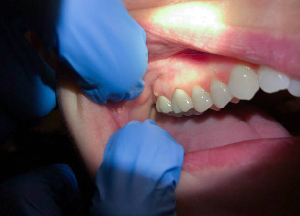 Best After-Hours Emergency Dentist in Beverly Hills, TX