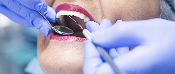 Best Emergency Dental Surgery in Beverly Hills, TX