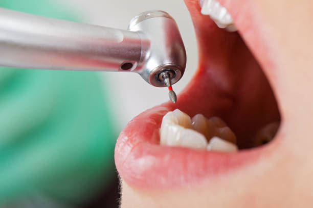 Best Emergency Treatment for Toothache in Beverly Hills, TX